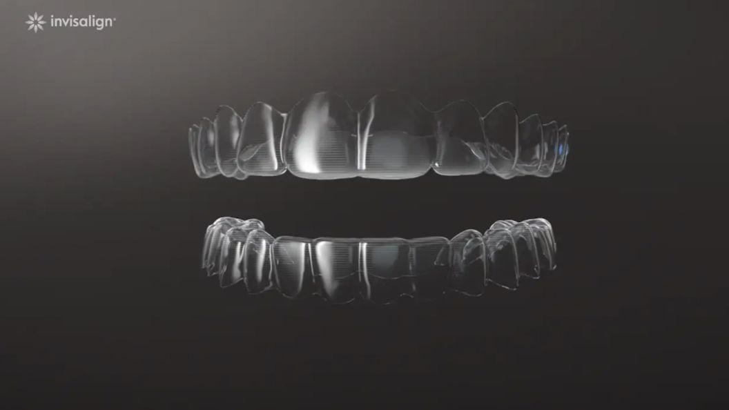 invisalign